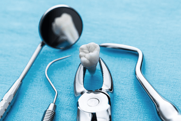 zubna-hirurgija-dr-prokic